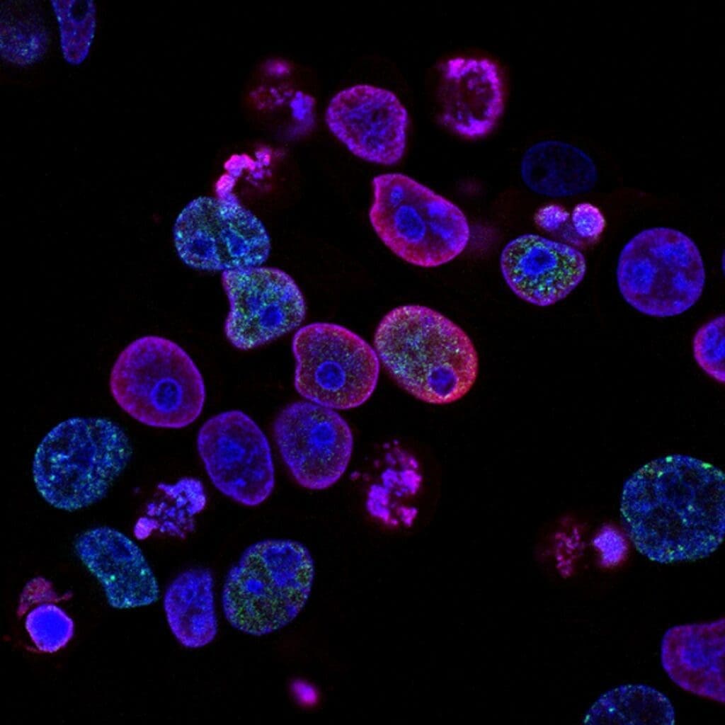 <strong>Rare Diseases (Not So for Patients) </strong> Pi2